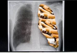 Cegah Kerusakan Paru Akibat Rokok dengan Vitamin D