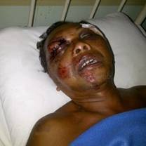 Suharto, Korban Tabrak Lari Terus Menunggu Operasi Dokter RS Sanglah