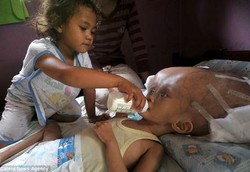 Si Kecil Dilla Tak Berdaya Melawan Kepalanya yang Terus Membesar