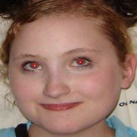 Menghilangkan Efek Red-Eye pada Foto