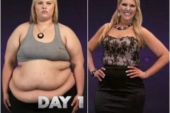 Potret Perjuangan Melawan Perut Gelambir Jadi Ramping