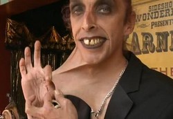 Pria Berkulit Paling Elastis di Dunia, Kulit Perutnya Bisa Jadi Meja