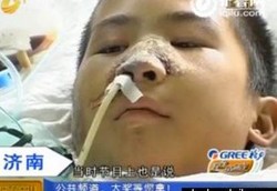 Bocah Lelaki Koma 8 Hari Karena Anusnya Dipasangi Kompresor