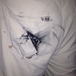 Ponsel Android Tiba-tiba Terbakar di Dalam Kantung