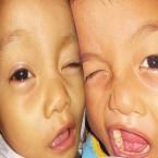 Dewi Maria Christie Nanga, 1,1 Tahun; Perempuan; f