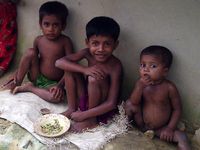 Gizi Buruk Serang Anak-anak Pengungsi Rohingya