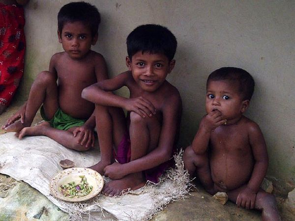 Gizi Buruk Serang Anak-anak Pengungsi Rohingya Gizi Buruk Serang Anak-anak Pengungsi Rohingya