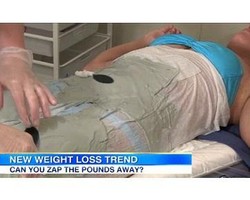 Pangkas Lemak Tubuh dalam Sekejap dengan Treatment Arus Listrik