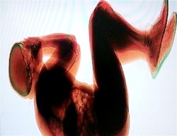 Tertidur di Baggage Belt, Traveler Masuk Mesin Sinar X!