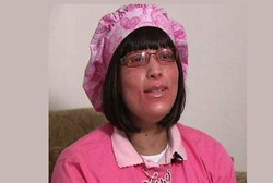 Kena Penyakit Misterius, Kuku Tumbuh Dari Seluruh Akar Rambut