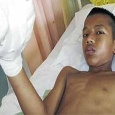 Duh! Gara-gara Main Petasan, ABG Malaysia Kehilangan 2 Jari Tangannya