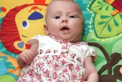 Bayi Hebat, Kalahkan Kista yang Besarnya Seukuran Melon