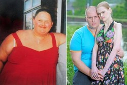 Kebablasan, Usai Melawan Obesitas Kini Bertempur dengan Anoreksia