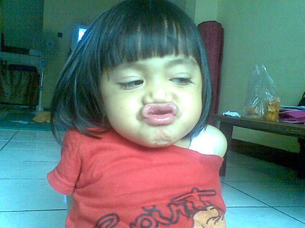 Davina Carissa Utomo, 3,1 Tahun, Perempuan