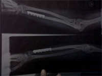 Taksiku Menabrak, Taksiku Tak Bertanggung Jawab