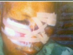 Polri: Mertua Terduga Teroris Tertendang Densus 88 karena Buru-buru