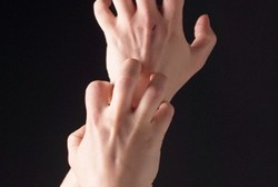 Jangan Mandi Air Panas dan Makan Telur Kalau Kulit Sering Gatal-gatal