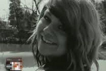 Korban-korban Keganasan Infeksi Bakteri Pemakan Daging