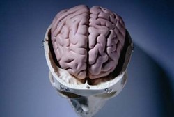 Hematoma intrakranial, Pecahnya Pembuluh Darah Otak Akibat Cedera Kepala