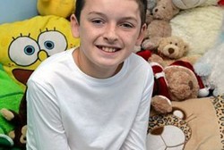 40 Kali Bolak Balik Operasi Kepala, si Bocah Tak Mengeluh