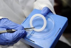 Cincin Vagina yang Bisa Lindungi Wanita dari HIV