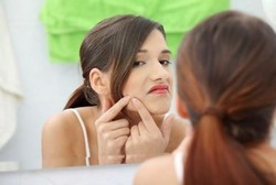 Habis Mencet Jerawat, Wajah Jadinya Begini