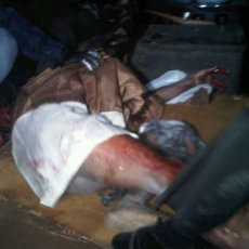 Ledakan di Depok, Kapolres: Pria yang Tangannya Nyaris Putus Tersangka