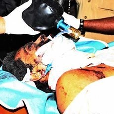  Ini Dia Foto-Foto Ledakan Bom Depok