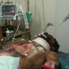 Kondisi Pria Diduga Thorik yang Dirawat RS Polri Dikabarkan Membaik