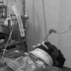 Kondisi Korban Kritis Akibat Ledakan di Depok: Tangan Nyaris Putus & Muka Gosong