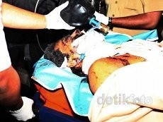 Thorik Menyerahkan Diri, Siapa Tersangka Bom Depok di RS Polri?