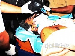 Identitas Tersangka Bom Depok Masih Gelap, Polisi Kerucutkan 2 Nama