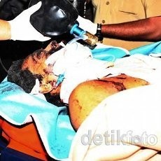 Dirawat di ICU RS Polri, Identitas Tersangka Bom Depok Masih Gelap