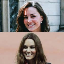 Perubahan Wajah Cantik Kate Middleton