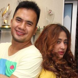 Saipul Jamil dan Dewi Persik Kompak Jalani Sulam Bibir