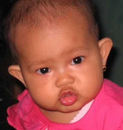 Humaira Yumna, 3,2 Tahun, Perempuan