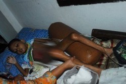 Jenazah Nando, Penderita Ginjal Dibawa ke Rumah Kakeknya