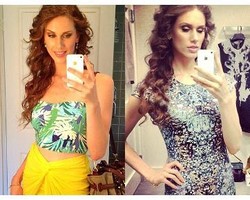 Model Berjerawat Terkenal Lewat You Tube Eksis di New York Fashion Week