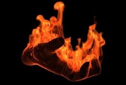 Pertolongan Pertama pada Luka Bakar Parah