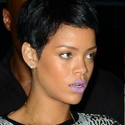 Rihanna Pasang Gigi Emas Seperti Chris Brown