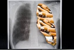 Ingat, Ingat! Efek Buruk Rokok Baru Terasa 20 Tahun