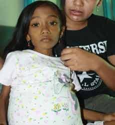 Silvia, Bocah 7 Tahun Terkena Radang Saluran Empedu Meninggal