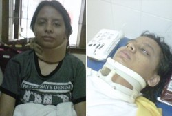 Regina Tak Kapok Tertimpa Gapura Demi Indonesia Bebas Rokok