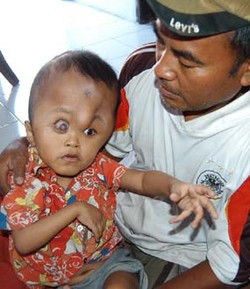 Disambangi Bupati, Bocah Penderita Hydrocephalus Kumandangkan Salawat