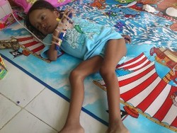 Kisah Nur Aidah yang Terbaring Tak Berdaya Akibat Dianiaya Ibu Kandungnya