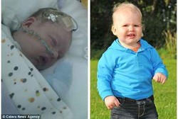 Masih Bayi Tapi Sudah Kena Stroke