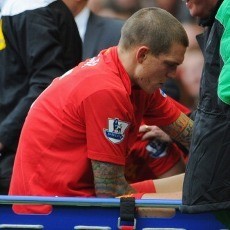 Liverpool Harap-harap Cemas Tunggu Kondisi Borini & Agger