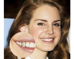 8 Selebriti Ini Bergigi Bling-bling