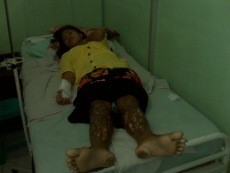 Ini yang Dirasakan Supiyati Setelah 75 Jarum Dikeluarkan dari Kakinya