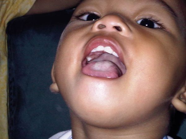 Rezvan Muhammad Attaya, 1,10 Tahun, Lelaki